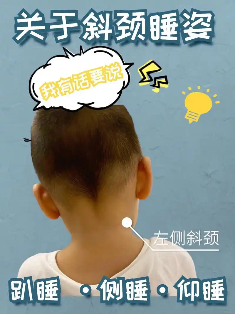 斜颈宝宝 #正确睡姿 #成长枕 - 抖音