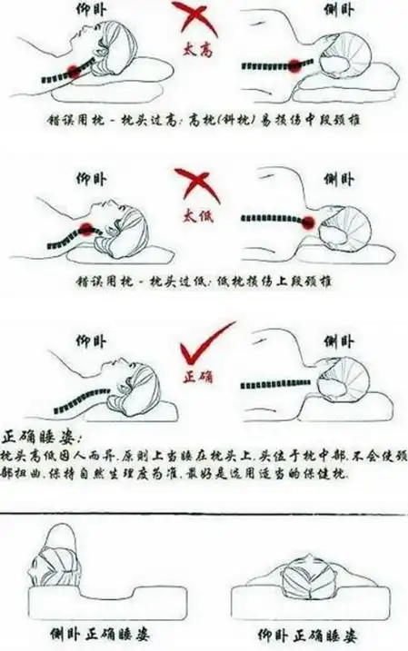 正确睡姿图片在侧卧位时,应经常改变侧卧方向.