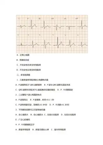 临床心电图试题集与答案doc