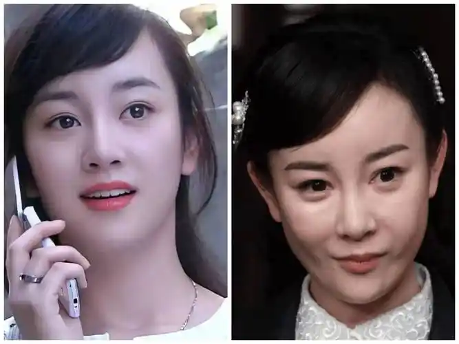 整容最失败的女明星,从清纯灵动到一脸硅胶,网友直呼太可惜了_张檬_角