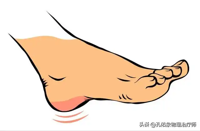 走路脚后跟疼怎么办