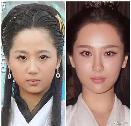 娱乐圈中整容最成功和最失败的女明星都是谁