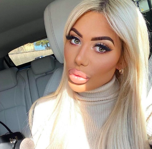 审美太畸形!24岁女星砸近百万整形,双唇秒变"魅力嘟嘟唇"!