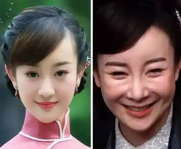 5位整容失败的女明星:蛇精脸,猪鼻头,面容僵,最后一位最惨